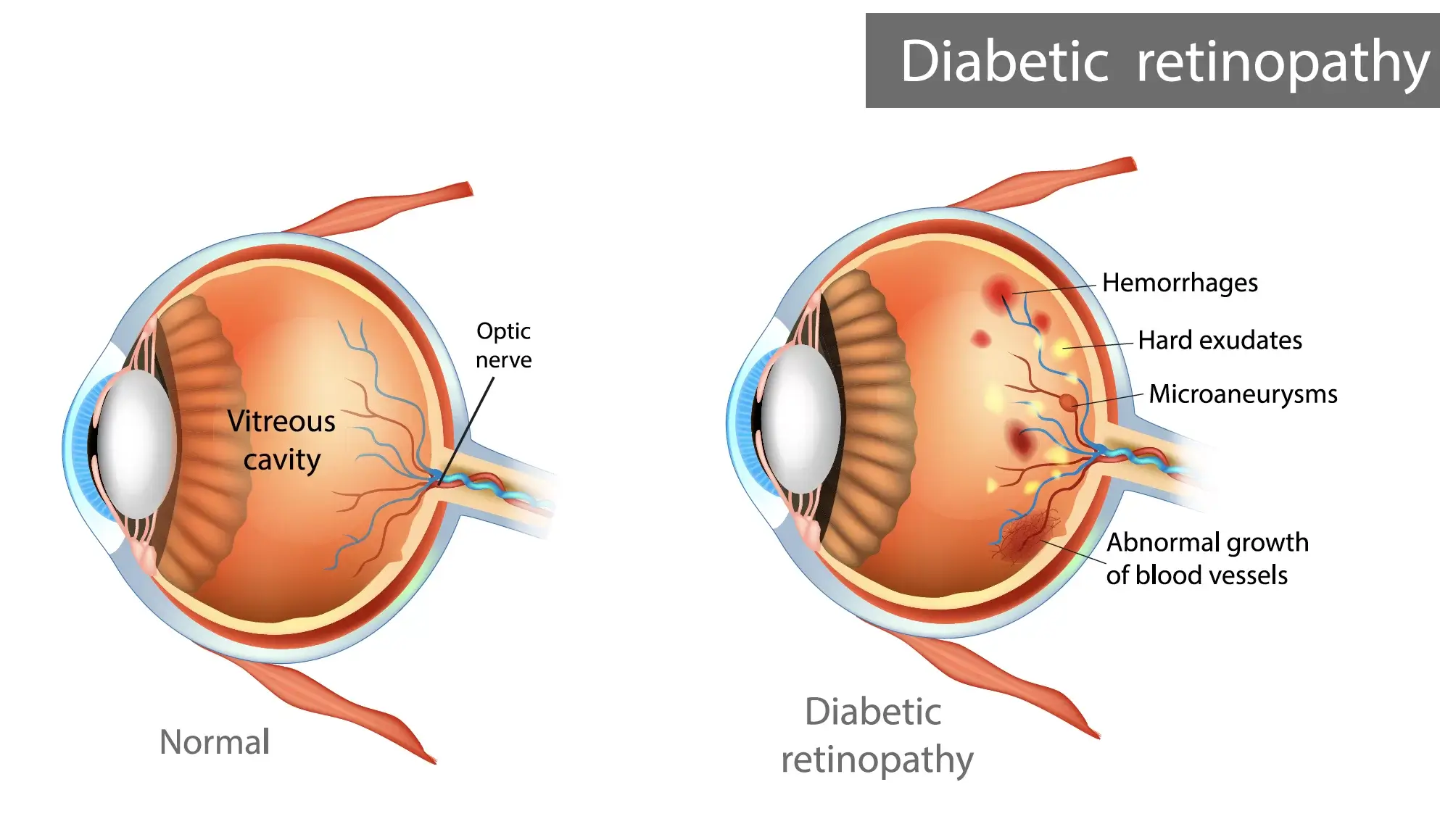 eye hospital in surat baroda