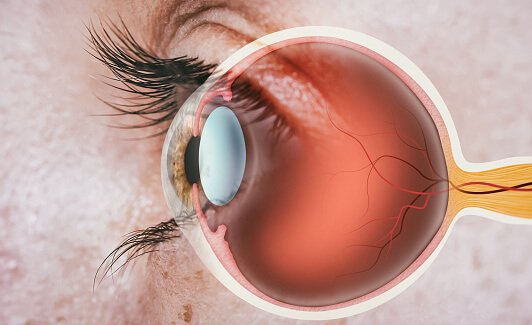glaucoma treatment in sura